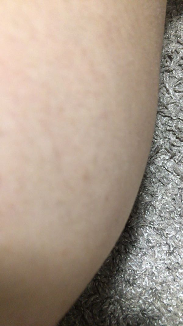 広い 値下げ 思い出させる 恋する おしり 石鹸 黒ずみ rsenault Net 広い 値下げ 思い出させる 恋する おしり 石鹸 黒ずみ rsenault Net
