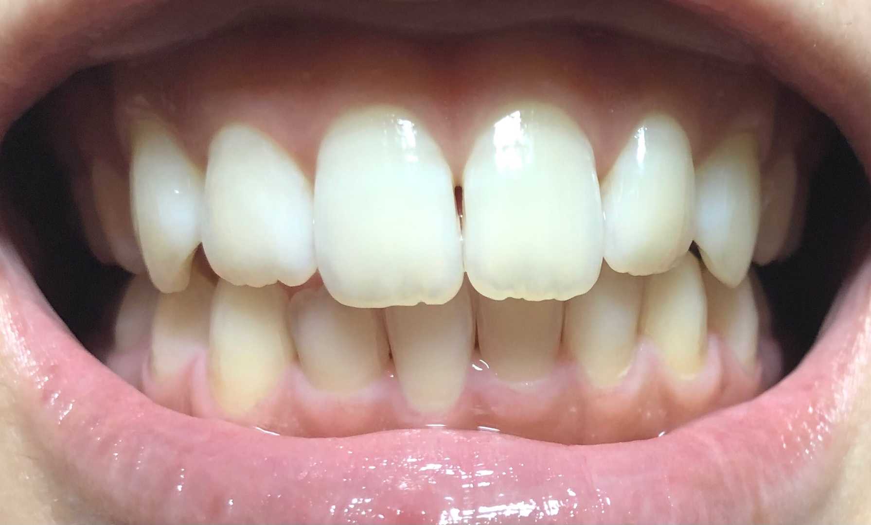 カテゴリ未分類 いい歯日記 楽天ブログ