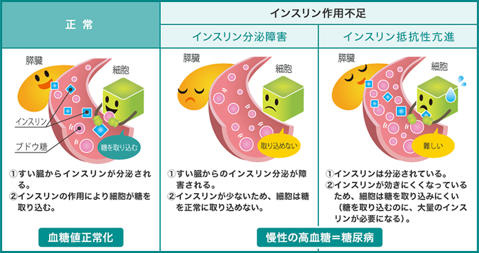 ムンジャロは前糖尿病や 2 型糖尿病を予防しますか?