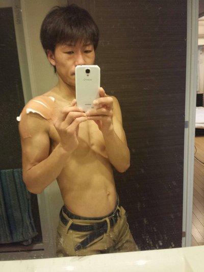 怪我