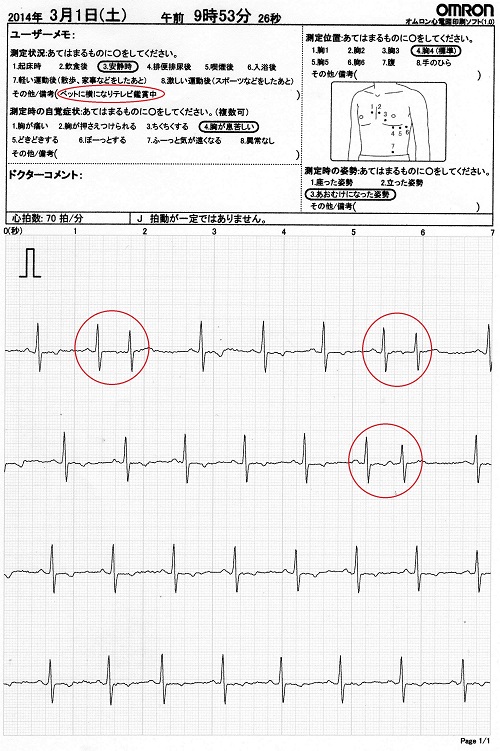 心電図