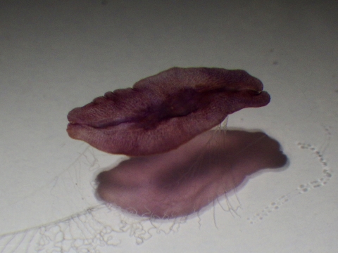 クラゲムシ属の一種（Coeloplana sp.）6　Coeloplana cf. bannwarthiの疑い