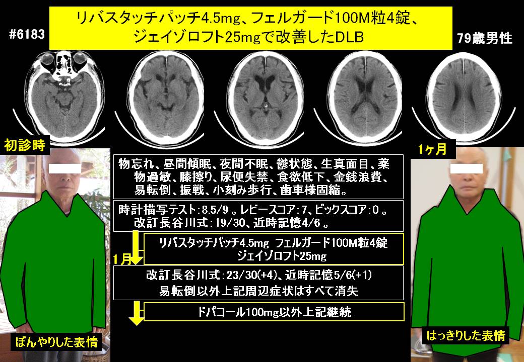 20160131@6183@615