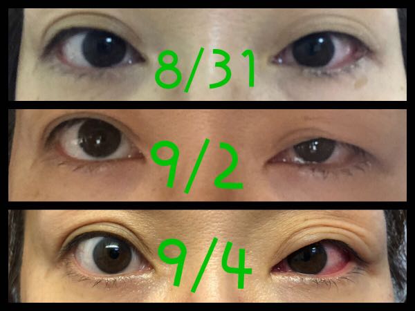 rblog-20180904174103-03.jpg