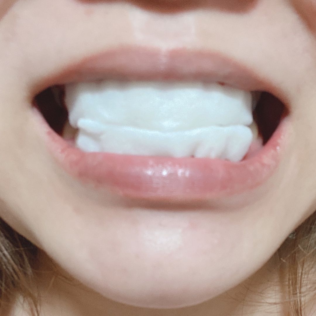 スマイルコスメティック ティースホワイトパック 代olのモニターな日々 楽天ブログ