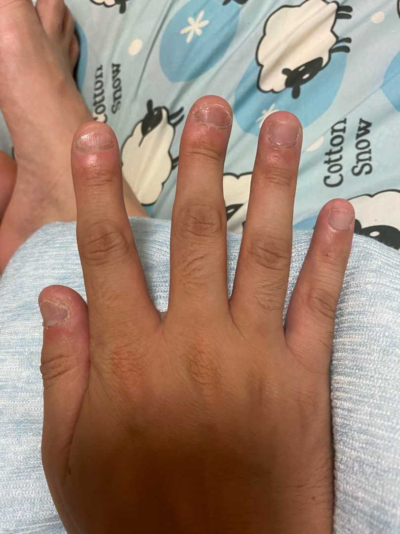 爪噛み克服 初日 爪噛み癖克服 記録と記憶 楽天ブログ