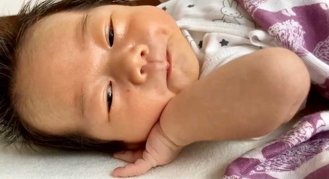 次女の赤ちゃん 目の下の傷 自分でひっかいちゃった 少し湿疹が出てきた ワセリン塗ってテカテカ とのこと 今日爪切った らしいからもう大丈夫かなｗ Music Land 私の庭の花たち 楽天ブログ