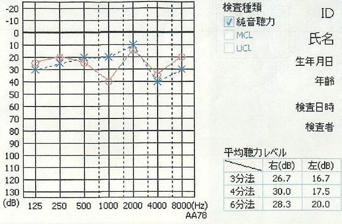 4:8オージオグラム.jpg