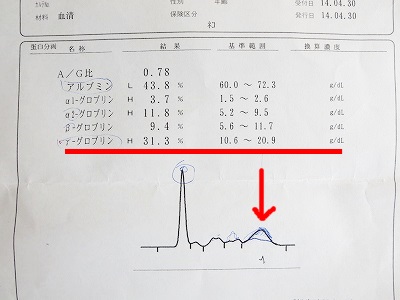 蛋白泳動検査