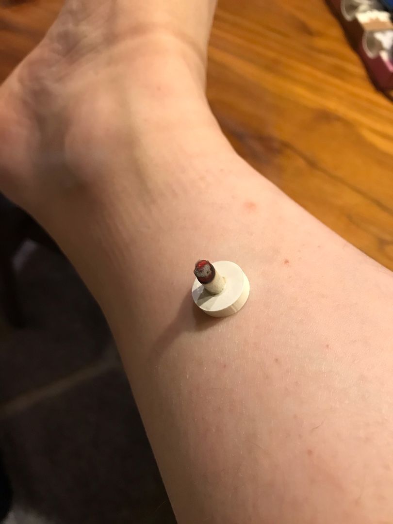 自分にお灸をすえる すてきもない時間 小さく豊かなくらしをめざして 楽天ブログ