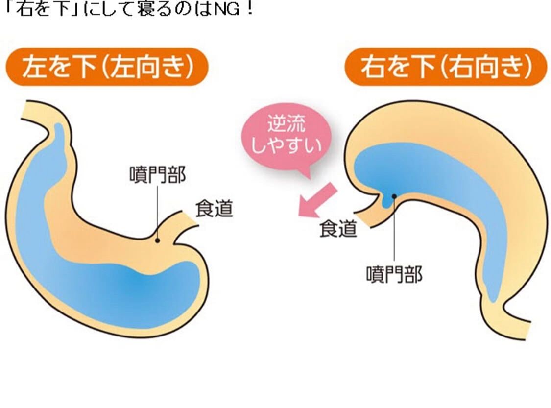 食後のしてはいけない 肺炎を招くある行動 Tomoraku の徒然 楽天ブログ