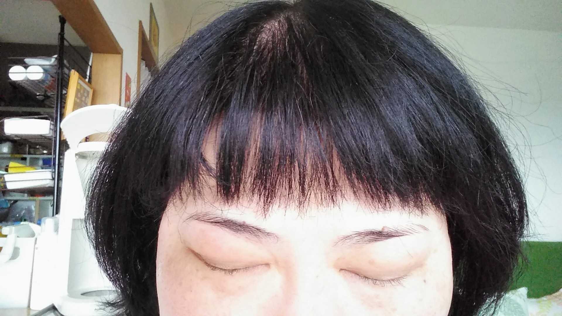 自慢の眉毛と まつ毛も抜けた 病気と生きる 楽天ブログ