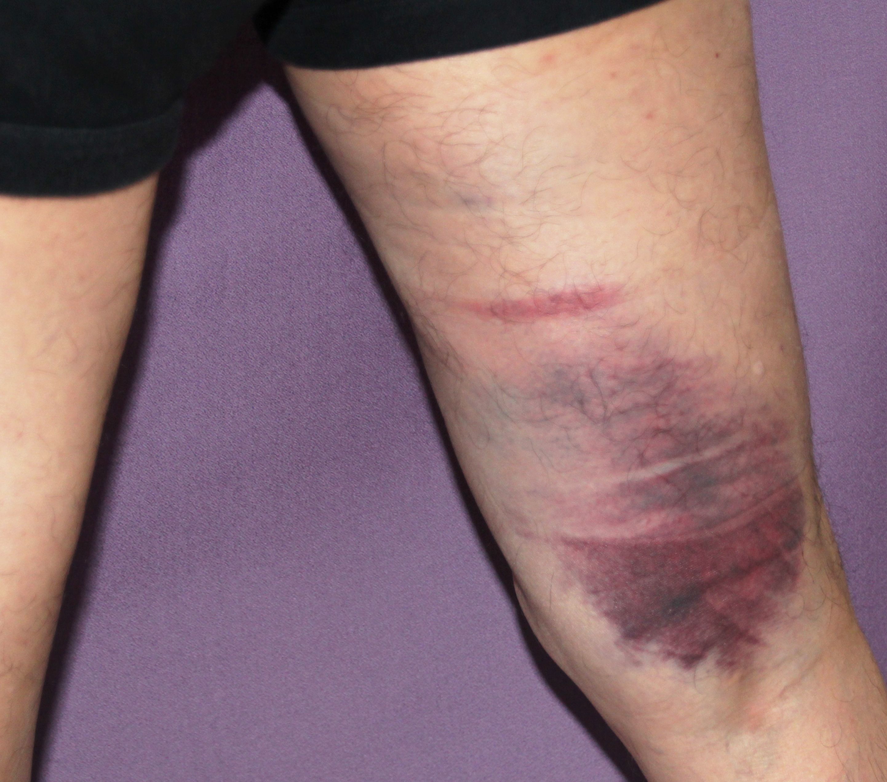 やっちまったぜ 北の狩人いい大砲だい 楽天ブログ