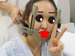 ガンマナイフ