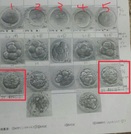 凍結胚盤胞 写真あり みきの不妊治療日記ときどきcocoa君~ 楽天ブログ