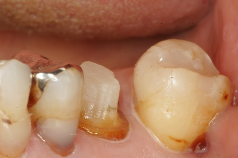 _MG_0041 のコピー.JPG