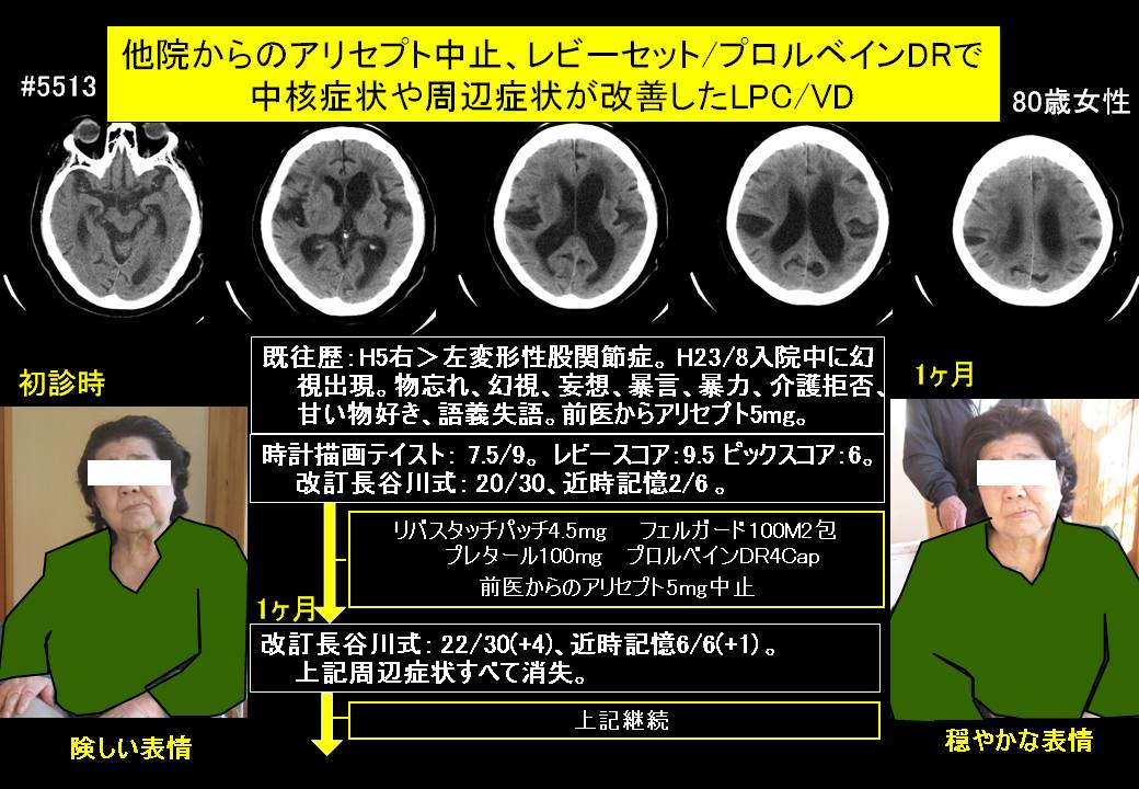 20141212@5513@293