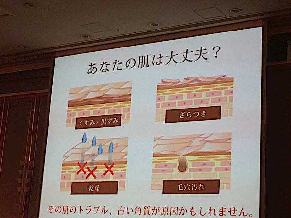 rblog-20160918200318-02.jpg