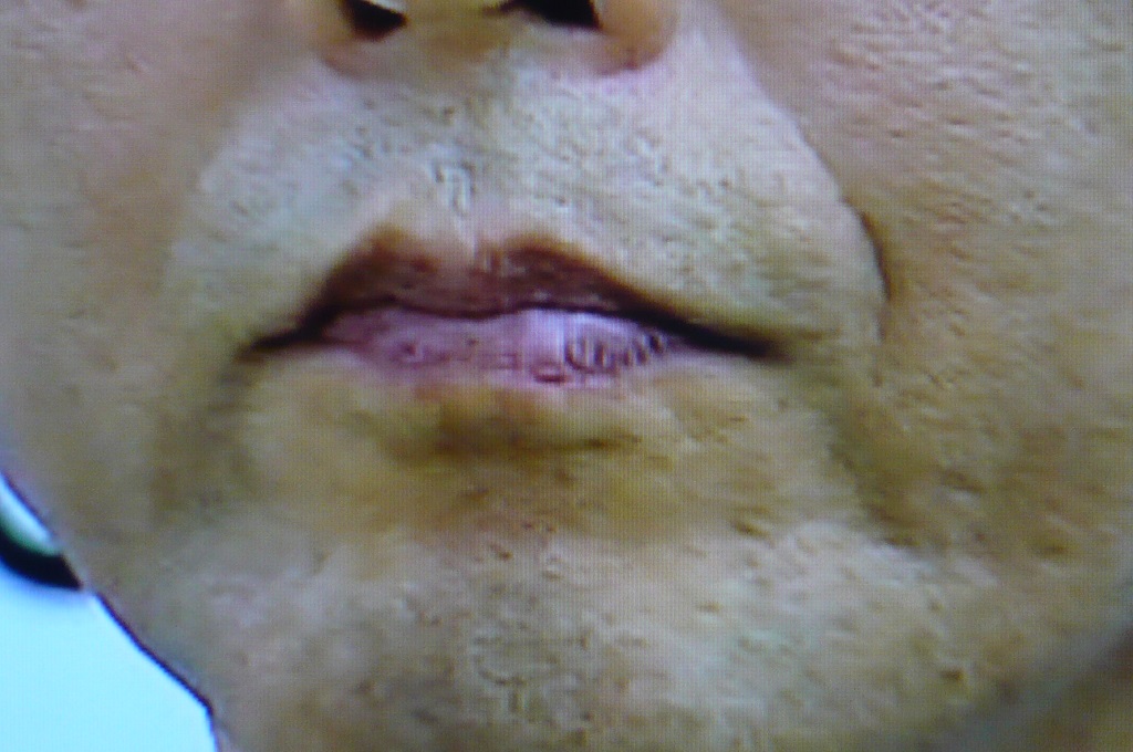 口