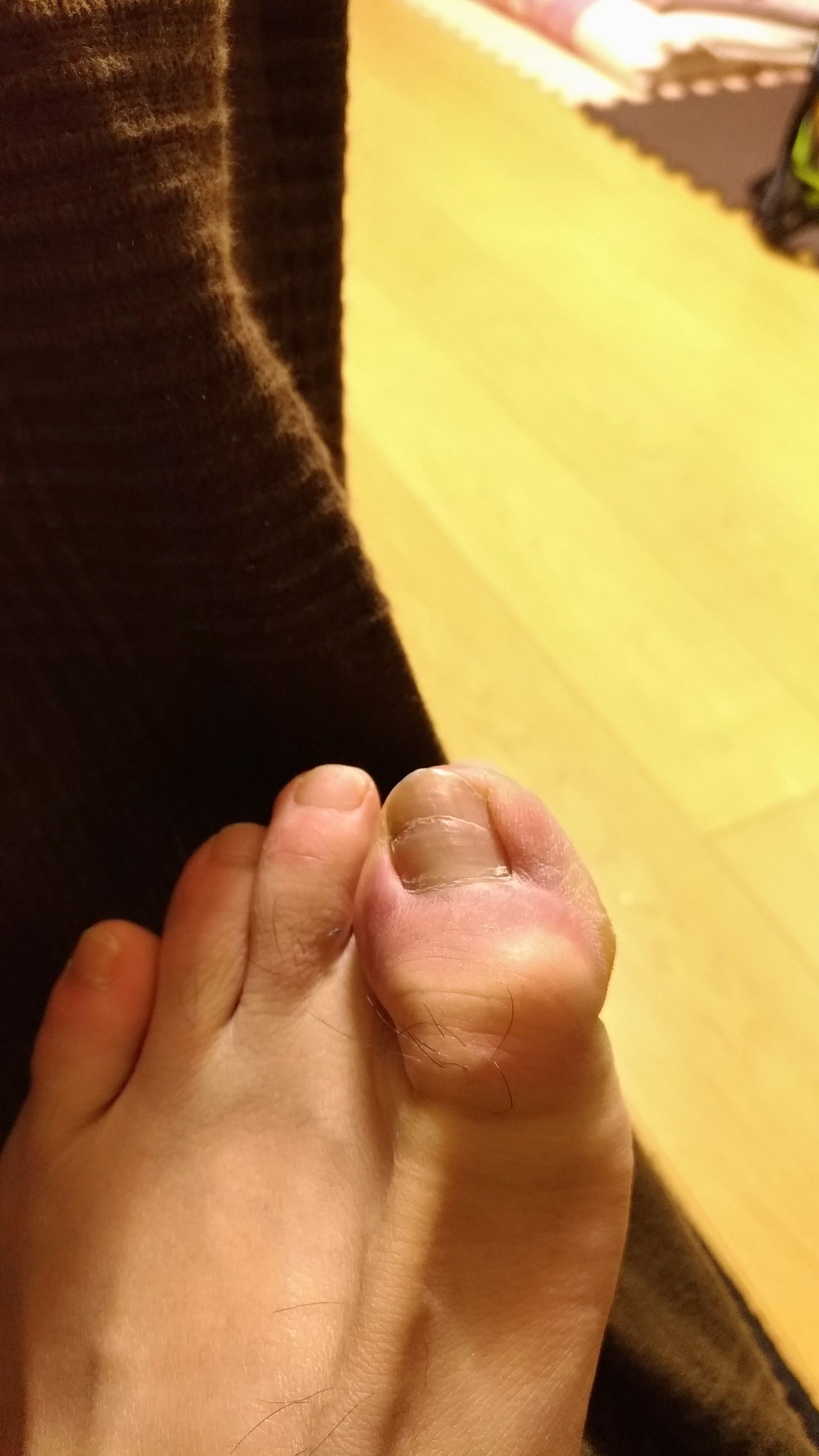 怪我病気 デュランボンのブログ 楽天ブログ