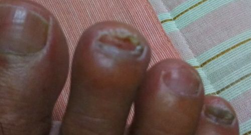 rblog-20170820175529-01.jpg