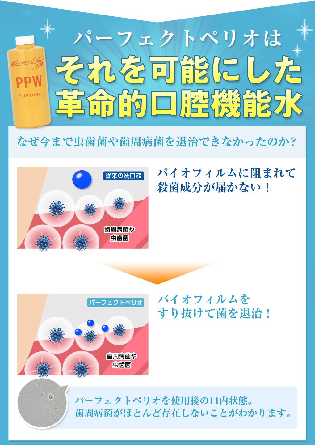 マウスウォッシュ 歯周病 口臭予防 パーフェクトペリオラプチャー500ml×2本セット ※45… | 語り、語られるための高樹涼の部屋 - 楽天ブログ