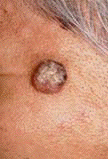 scc2.gif