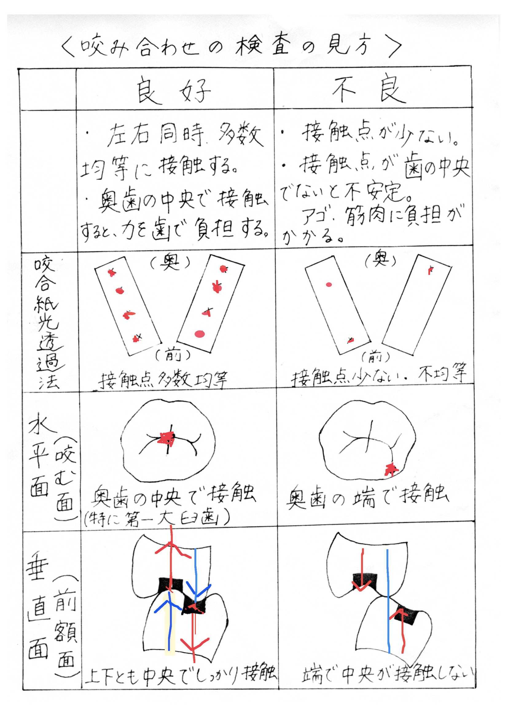 顎関節症 咬み合わせ オタク日記 川村歯科 かみ合わせ矯正歯科 In 仙台 顎関節症リハビリ 快適咬合を求めて 楽天ブログ