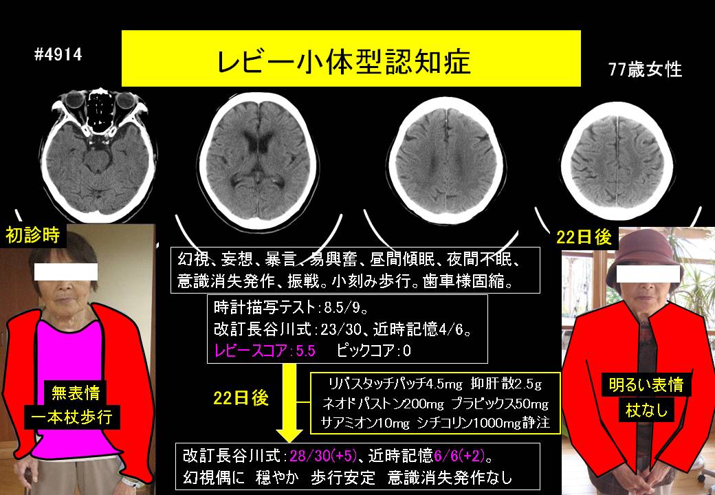 28ページ目の記事一覧 ドクターイワタの認知症 発達障害ブログ 認知症専門外来と認知症専門往診を融合 楽天ブログ