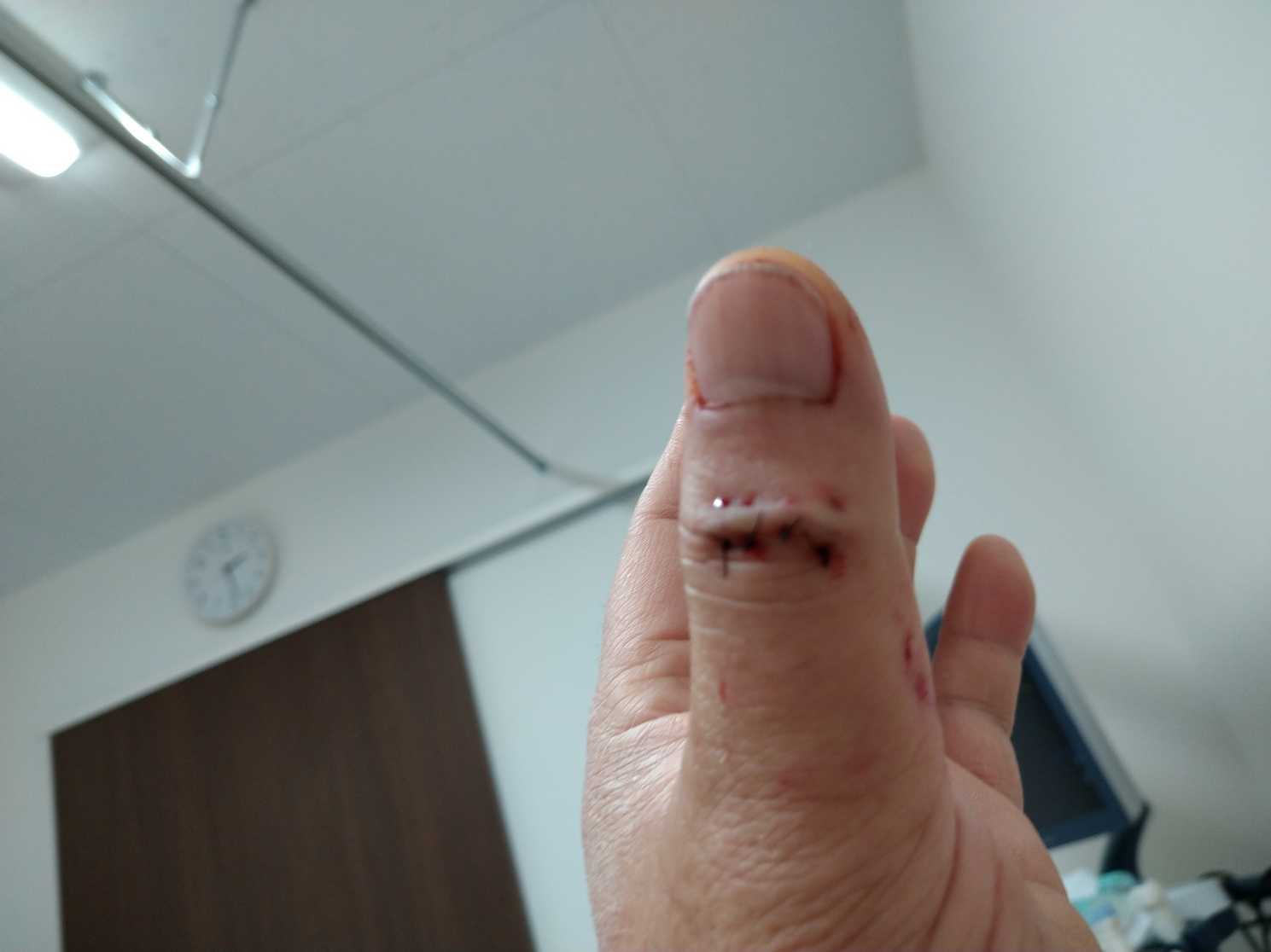 またやってしまいました いしちゃんの趣味の部屋 楽天ブログ またやってしまいました いしちゃんの趣味の部屋 楽天ブログ