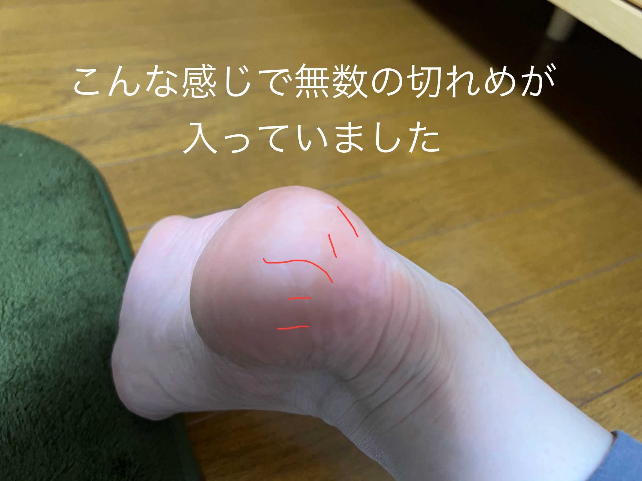 カクトル心斎橋店】踵の角質をナイフで削るとは？仕上がったよ編 