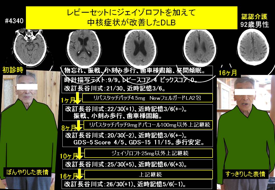 20141114@4340@269