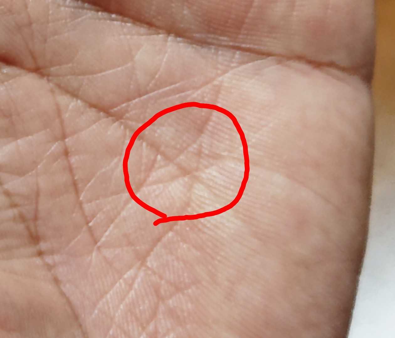 ソロモンの星 統合失調症から農業nomichi 楽天ブログ