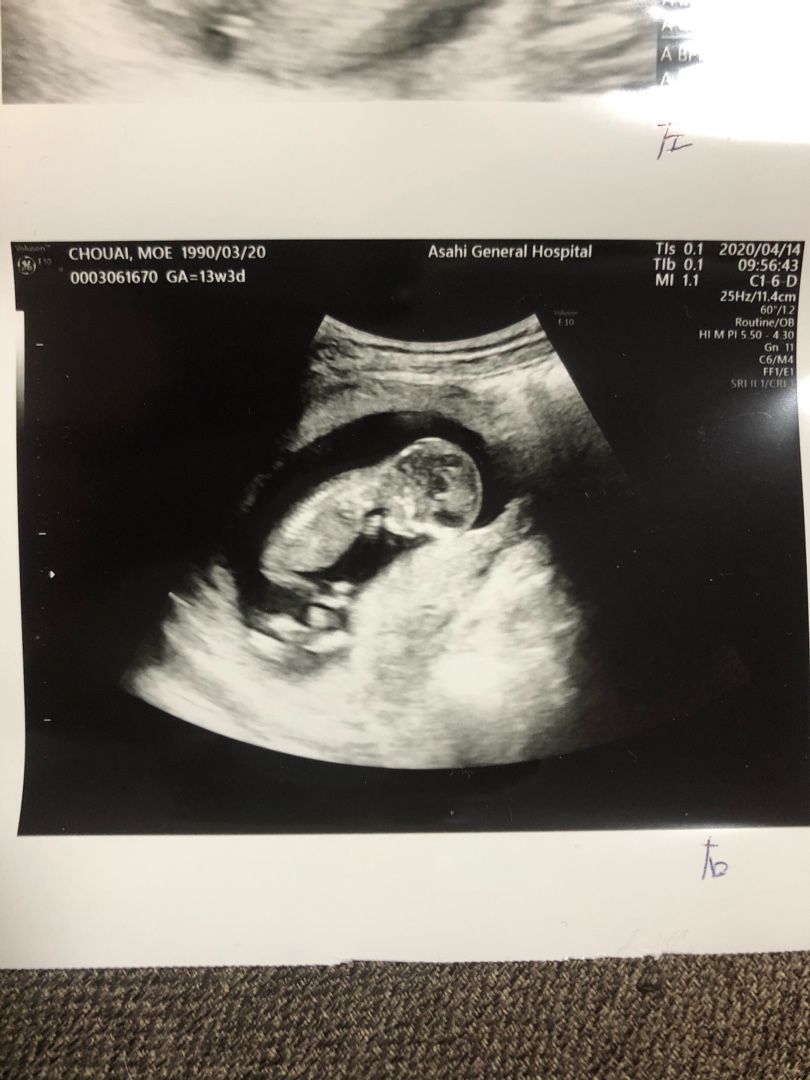 初めての妊婦健診 13w3d まさかの双子 妊娠 育児日記 楽天ブログ