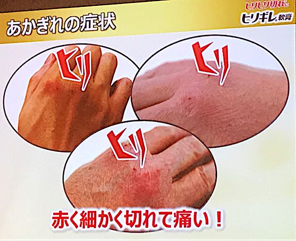 rblog-20181205174050-01.jpg