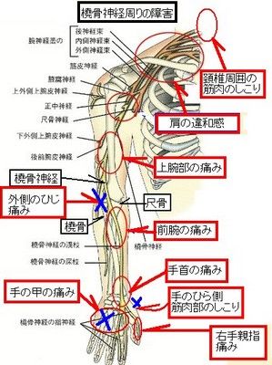 右親指の痛みの回復 Walk In The Spirit 楽天ブログ