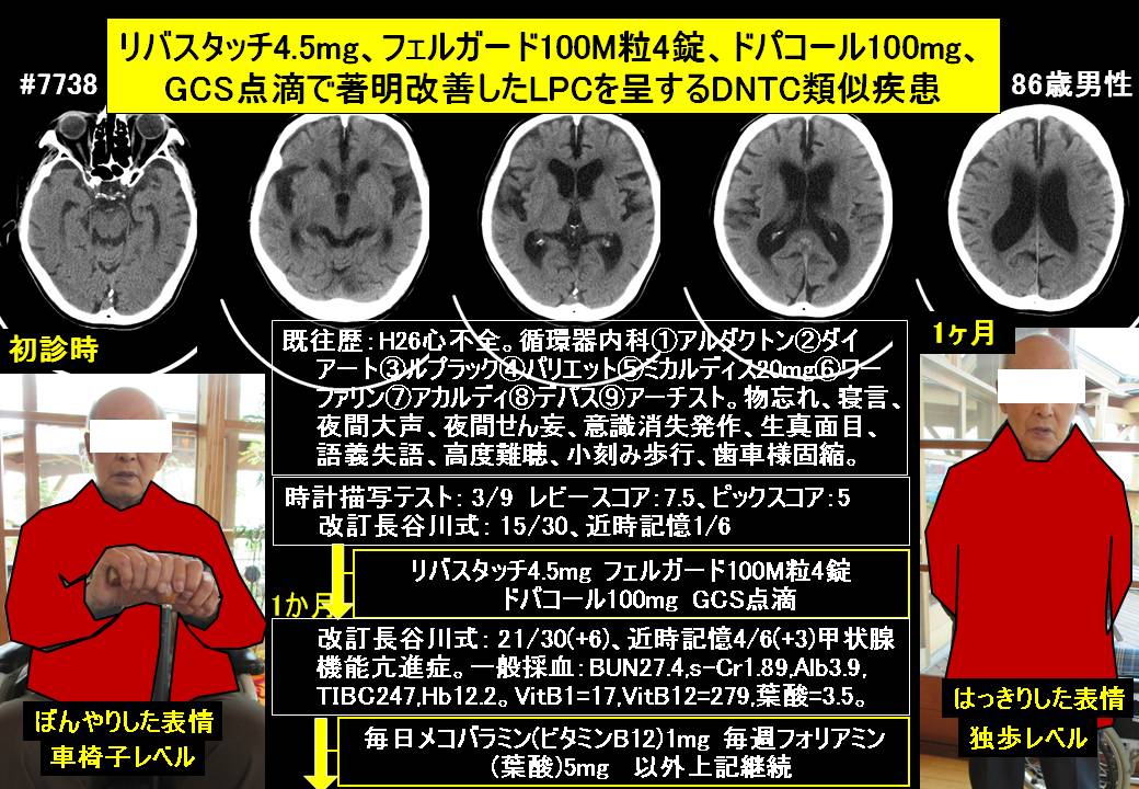 ドクターイワタの認知症ブログ2019年2月10日 ドクターイワタの認知症 発達障害ブログ 認知症専門外来と認知症専門往診を融合 楽天ブログ