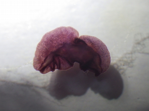 クラゲムシ属の一種（Coeloplana sp.）5　Coeloplana cf. bannwarthiの疑い