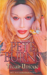 PETEBURNS