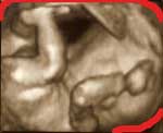 妊娠18週目の3D画像