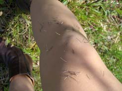 桜ﾘﾊﾞｰｻｲﾄﾞﾊﾟｰｸ・脚が…！！