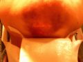 あご