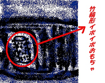 レントゲン（イメージです）