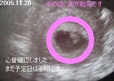 2005.11.26 ５Ｗくらい？