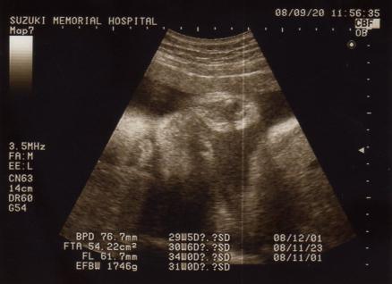 08.09.20(32w5d)