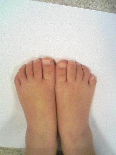 手術1週間前　１