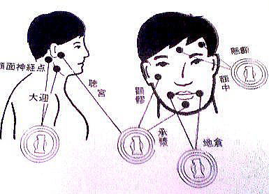 １円のツボ