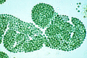 シアノバクテリア　提供　国立環境研究所.jpg