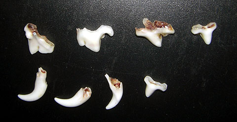 ANNIEの乳歯