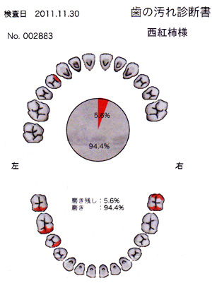 歯.gif